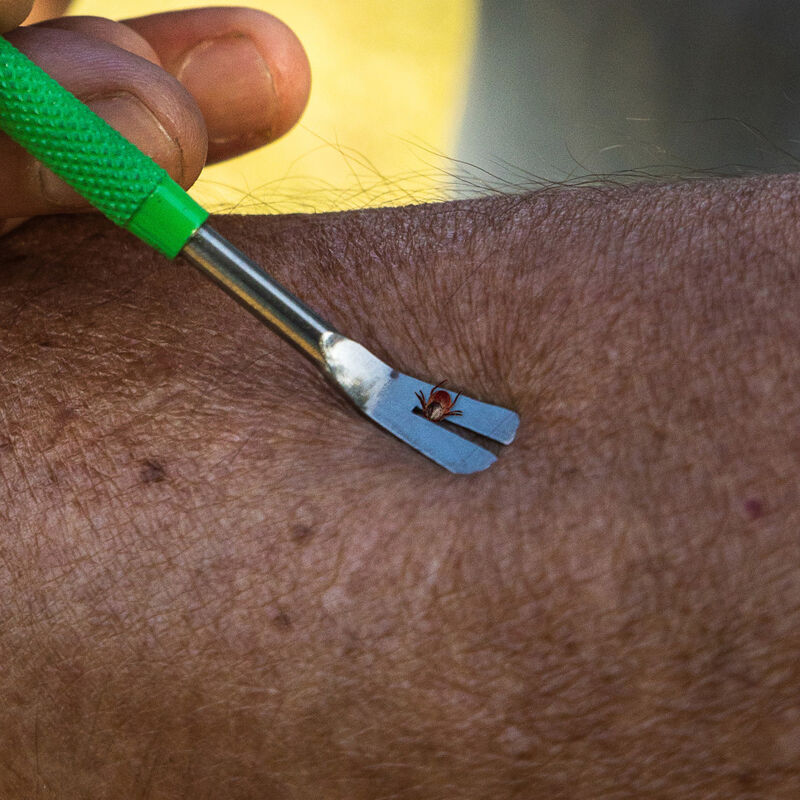 TickCheck Premium Tick Remover Kit image number null